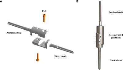 Clinical efficacy of customized modular prosthesis in the treatment of femoral shaft metastases